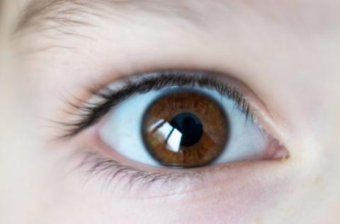 ทำไมต้องระวังทั้งตาแห้งและต้อเนื้อ สองปัญหาที่เชื่อมโยงกัน